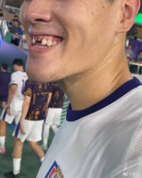😨太惨了！津门虎0-2不敌浙江，中卫王献钧门牙在比赛中被撞掉